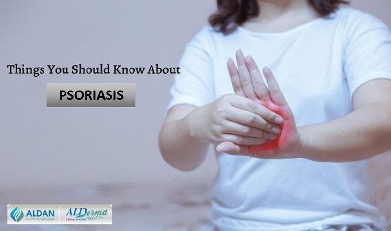 Things You Should Know About Psoriasis | Psoriasis Symptoms