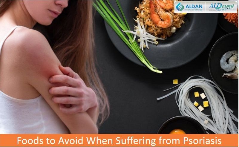 Foods to Avoid When Suffering from Psoriasis