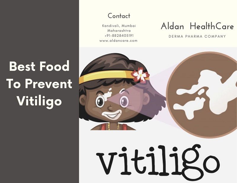 best food to prevent vitiligo