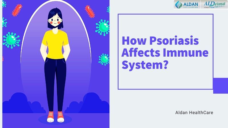 how psoriasis affects immune system