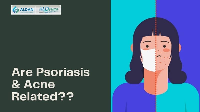 are psoriasis and acne related