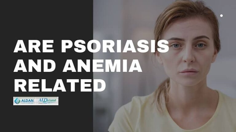 are-psoriasis-and-anemia-related-does-low-iron-cause-scalp-psoriasis