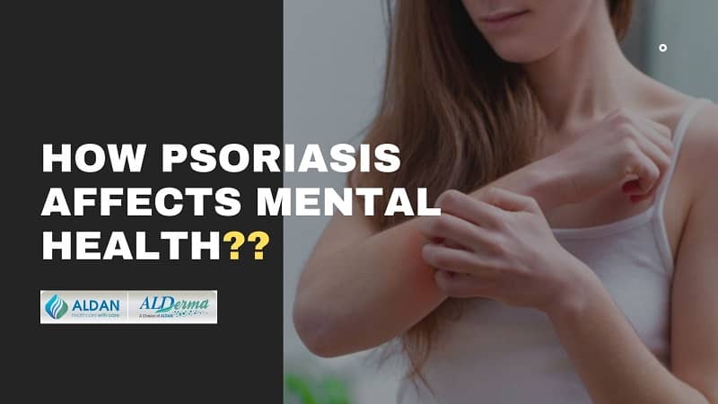 how psoriasis affects mental health