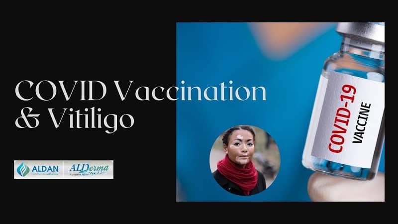 COVID Vaccination And Vitiligo