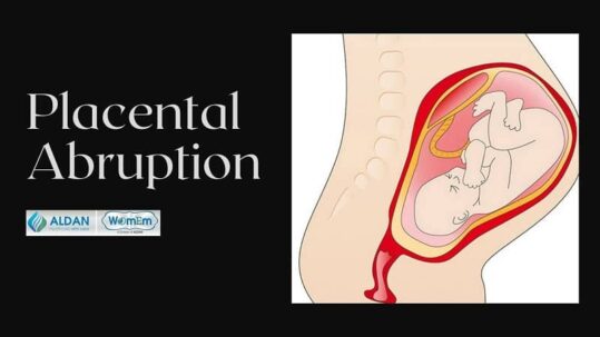 placental-abruption-types-symptoms-treatment