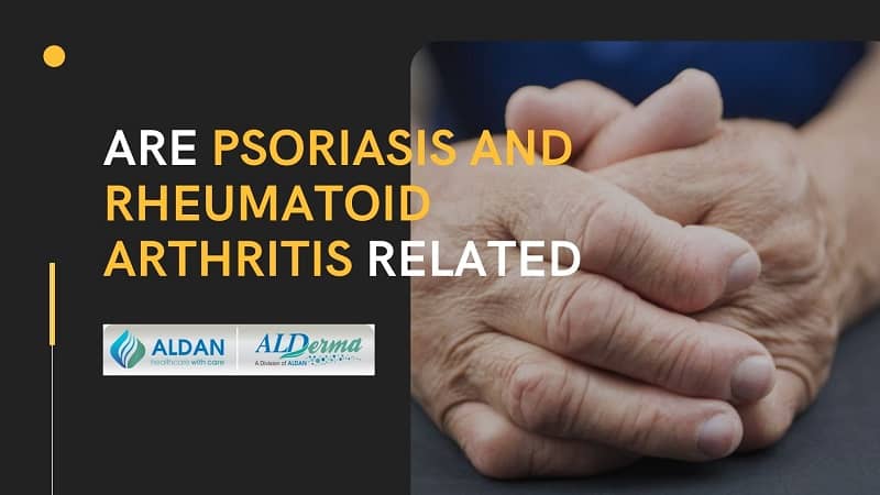 Are Psoriasis and Rheumatoid Arthritis Related?